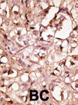 XLKD1 Antibody (N-term)