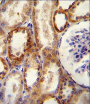 CD73 (NT5E) Antibody (N-term)