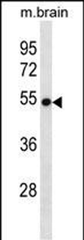 VANGL2 Antibody (N-term)