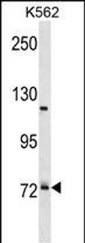 PRPF39 Antibody (C-term)