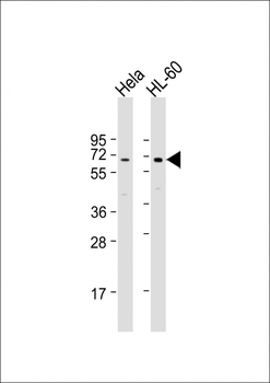 PIGB Antibody (N-term)