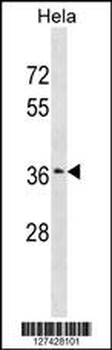 ZSCAN23 Antibody (Center)