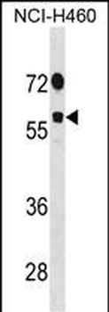 DDX19B Antibody (N-term)