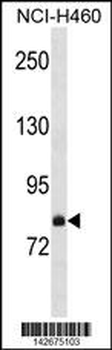 FCSD2 Antibody (C-term)