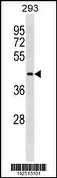 DIRC2 Antibody (Center)