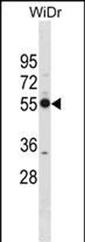 PSMD12 Antibody (Center)