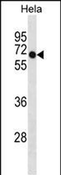DEPDC7 Antibody (C-term)