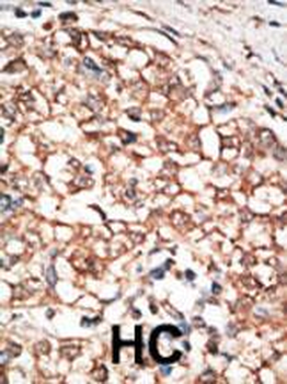 BMPR1B Antibody (C-term)