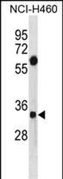 SDCBP Antibody (N-term)