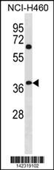 NHLRC3 Antibody (C-term)