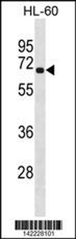 RLIM Antibody (Center)