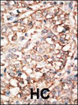 BMPR1A Antibody (C-term)