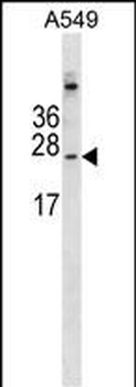 CALML6 Antibody (Center)