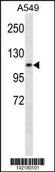 CHSY3 Antibody (Center)