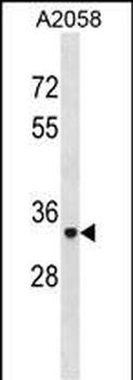 ACP5 Antibody (N-term)