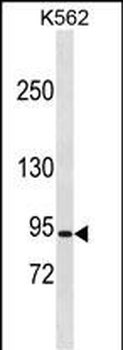 CLCN5 Antibody (N-term)
