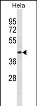 ADPRH Antibody (C-term)