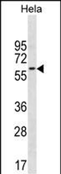 CD3EAP Antibody (N-term)