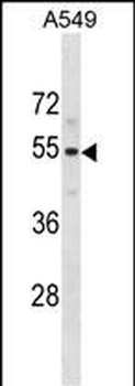PUS10 Antibody (N-term)