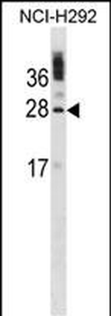 CIB1 Antibody (C-term)