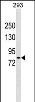 DCLK2 Antibody (N-term)