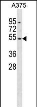 DUSP10 Antibody (Center)