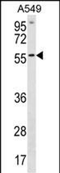 ETV5 Antibody (N-term)