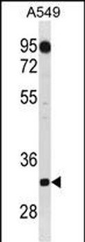 C1QTNF2 Antibody (C-term)