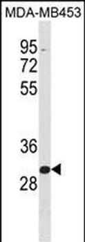 ZNF367 Antibody (C-term)