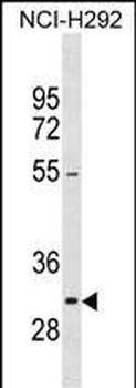 MKI67IP Antibody (C-term)