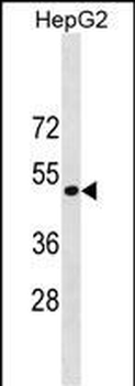 ST6GAL1 Antibody (Center)