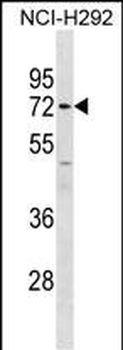 MMP14 Antibody (C-term)