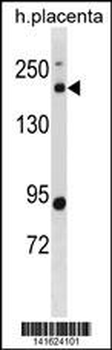 BCL9L Antibody(N-term)