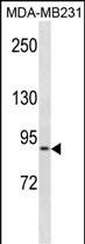 KIRREL Antibody(C-term)