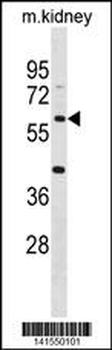 ACSM4 Antibody(C-term)