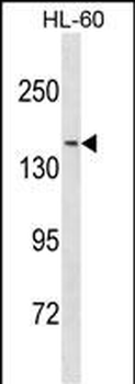 NCOA3 Antibody (N-term)