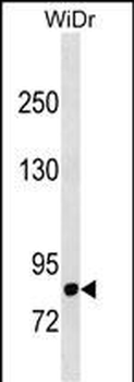 DPP4 Antibody (N-term)