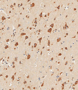 STAT1 Antibody (C-term)