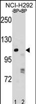 PARP1 Antibody (N-term)