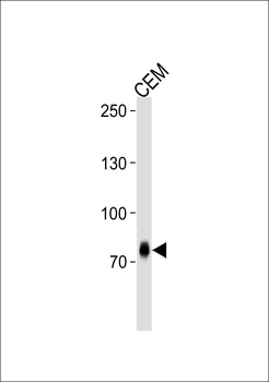 ZNF219 Antibody (C-term)