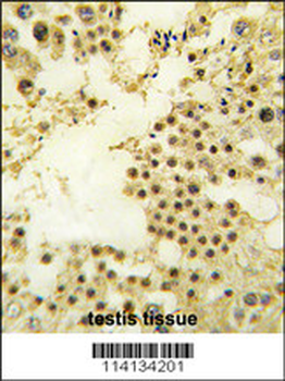 ZNF219 Antibody (N-term)