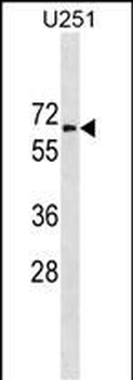GGT1 Antibody (N-term)