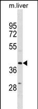 ZFP36L1 Antibody(N-term)