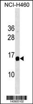 GAPT Antibody(Center)