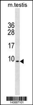 PDE6H Antibody(Center)