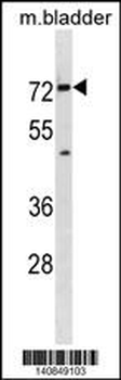 Mouse Slc5a8 Antibody (C-term)
