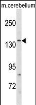 GRIN2C Antibody (Center)