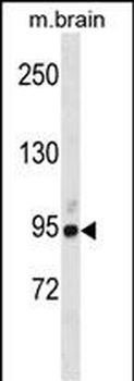 BRSK1 Antibody(Center)
