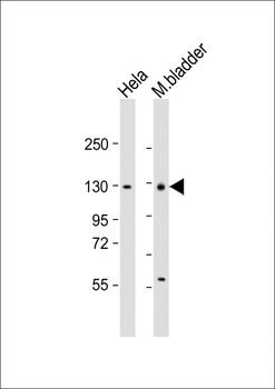 Mouse Enpp1 Antibody (N-term)