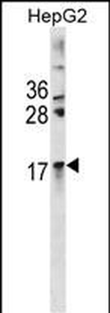 CRYAA Antibody(Center)